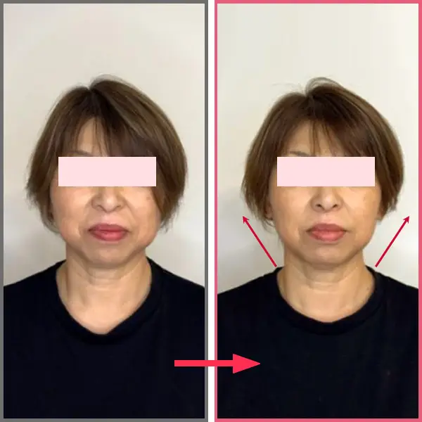 ハリのあるお顔に