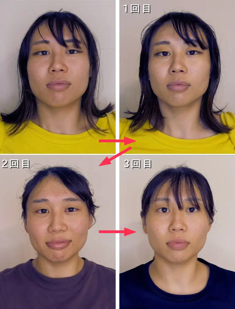 3回受けられた方のビフォーアフターの一例